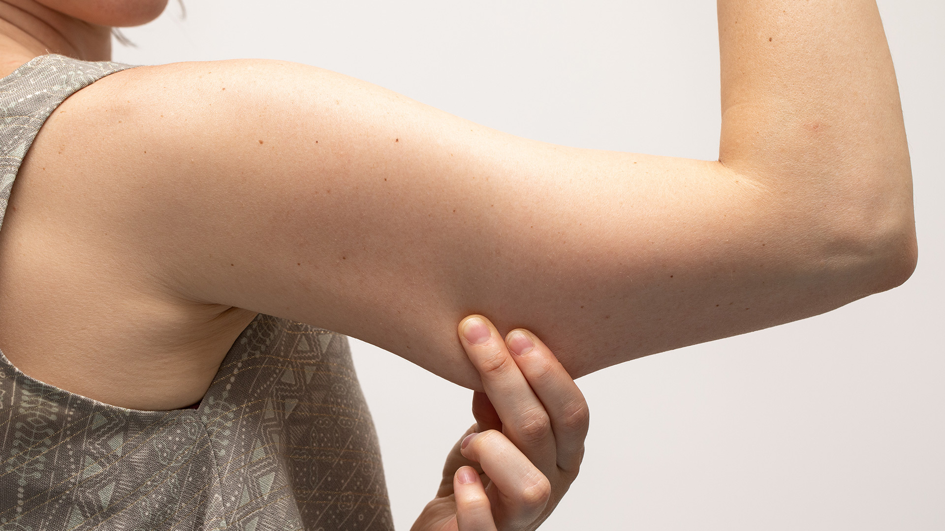 TONE ’EM UP: THE REMEDIES TO FIRM UP SAGGING ARMS.